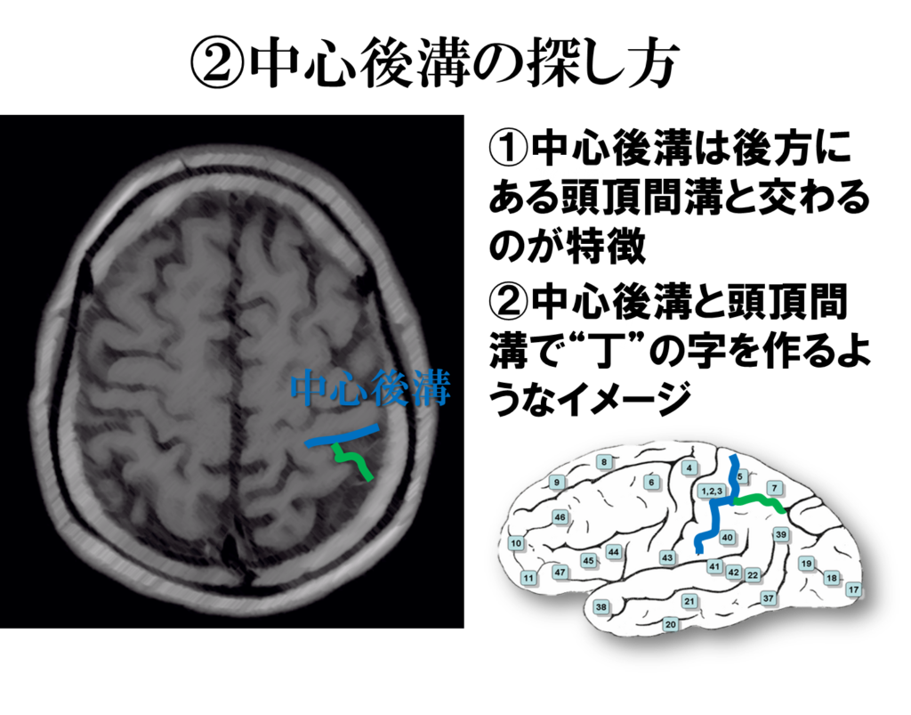 脳溝 Sulcus Neuroanatomy Japaneseclass Jp