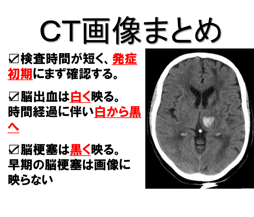 立派な Ct 画像 見方 サマロンデ