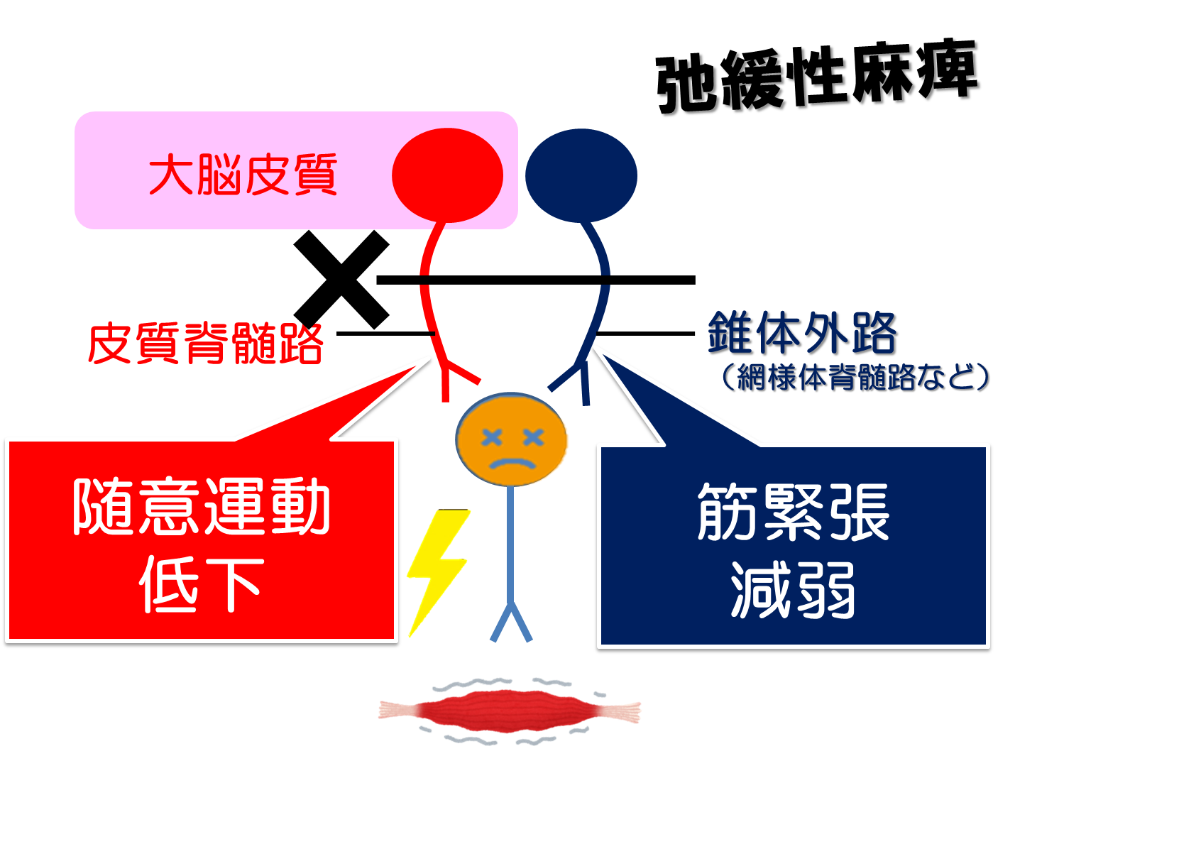 運動麻痺の種類や評価は？運動麻痺のメカニズムから紐解くリハビリの工夫 | リハアイデア