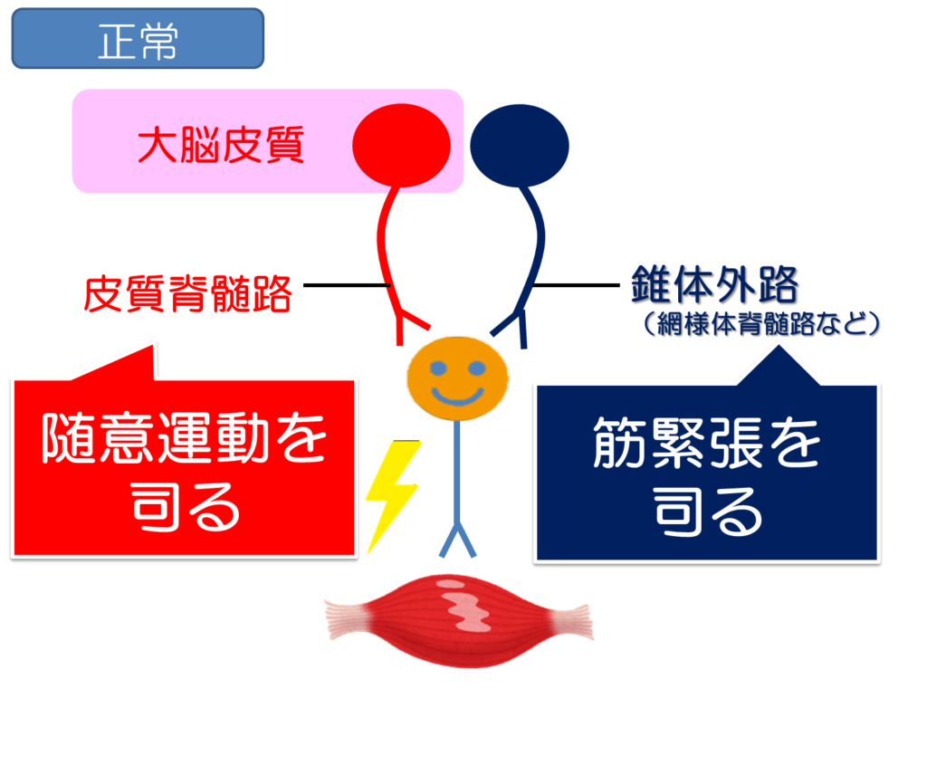 運動麻痺の種類や評価は 運動麻痺のメカニズムから紐解くリハビリの工夫 リハアイデア